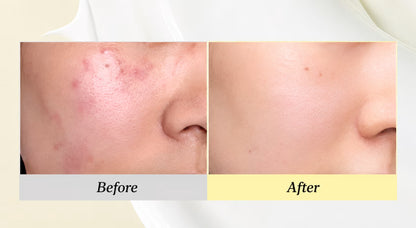 DR Althea 345 relief cream