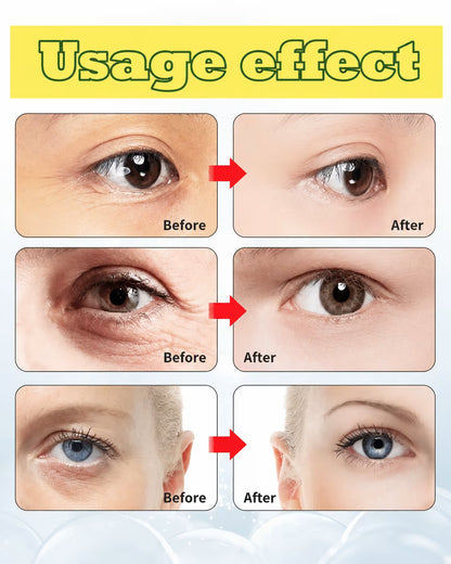 Celimax the Vita A Cream Retinal Shot Tightening Booster