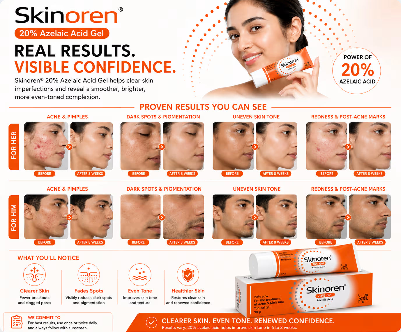 Skinoren Azelaic Acid 20% Cream