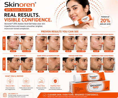 Skinoren Azelaic Acid 20% Cream