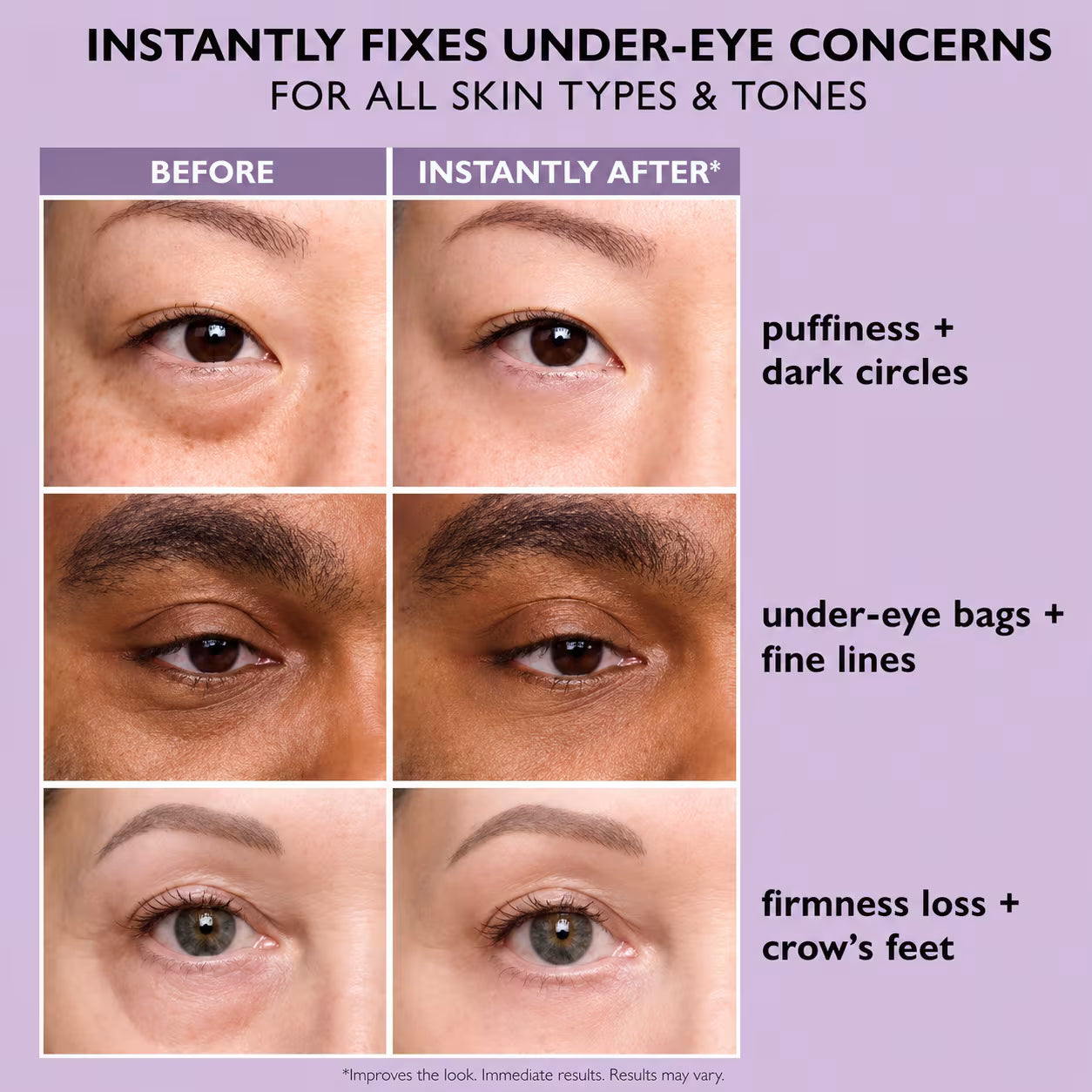 Peter Thomas Roth Instant FIRMx Eye Tightener
